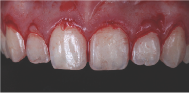 Click here to view Large Figure 5