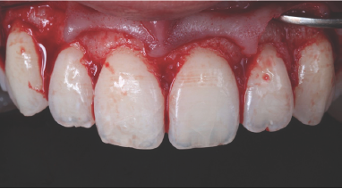 Click here to view Large Figure 7