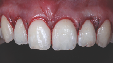 Click here to view Large Figure 9