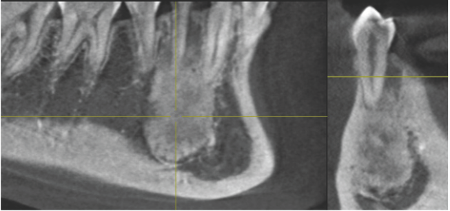 Click here to view Large Figure 3