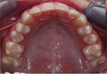 Click here to view Large Figure 4