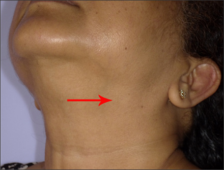 Click here to view Large Figure 1