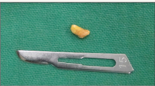 Click here to view Large Figure 11