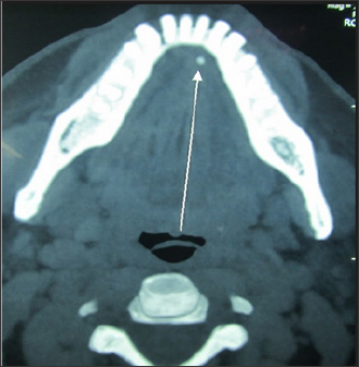 Click here to view Large Figure 2