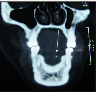 Click here to view Large Figure 2b