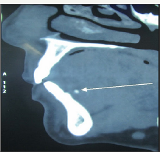 Click here to view Large Figure 2c