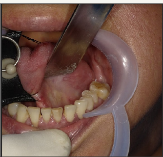 Click here to view Large Figure 3