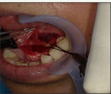 Click here to view Large Figure 4