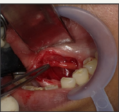 Click here to view Large Figure 5