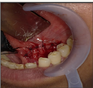 Click here to view Large Figure 6