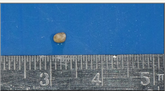 Click here to view Large Figure 7