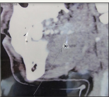 Click here to view Large Figure 9a