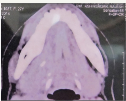 Click here to view Large Figure 9b