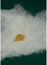 Click here to view Large Figure 3