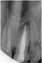 Click here to view Large Figure 4