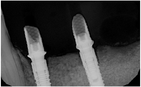 Click here to view Large image 22