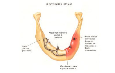 Click here to view Large image 1