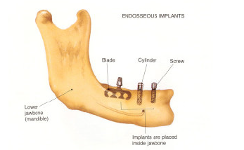 Click here to view Large image 2