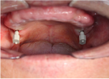 Click here to view Large image 2B