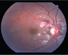 Click here to view Large Figure 1