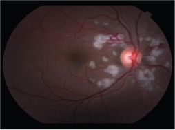 Click here to view Large Figure 1