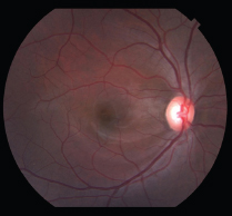 Click here to view Large Figure 1