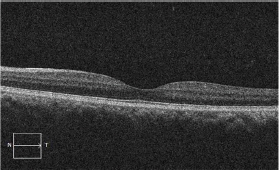 Click here to view Large Figure 1