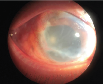 Click here to view Large Figure 1