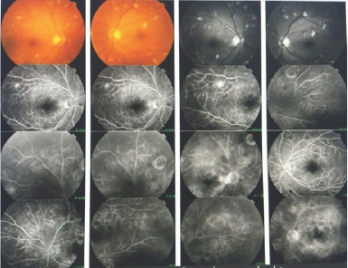 Click here to view Large Figure 1