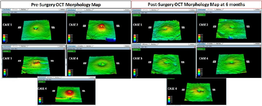 Click here to view Large Figure 1