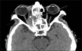 Click here to view Large Figure 2