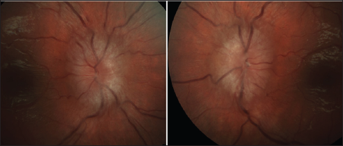 Click here to view Large Figure 2