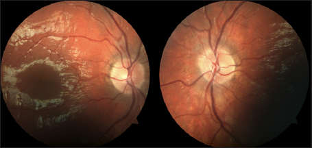 Click here to view Large Figure 4