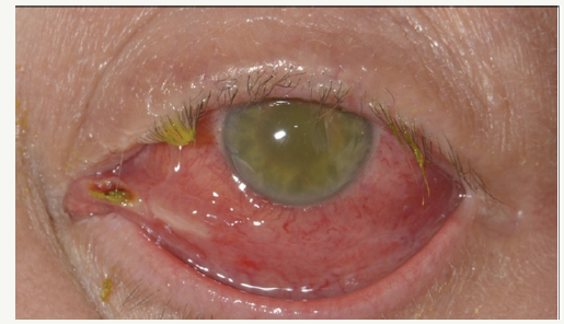 Click here to view Large image 2