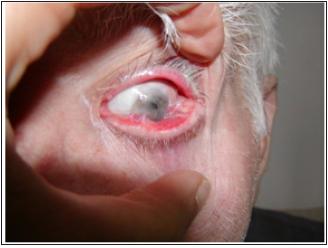 Click here to view Large image 1a