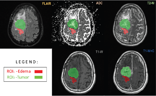 Click here to view Large Figure 1