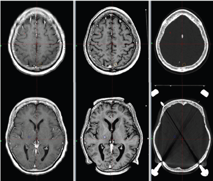 Click here to view Large Figure 3