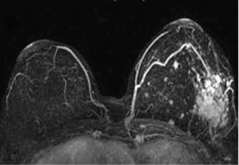 Click here to view Large Figure 4