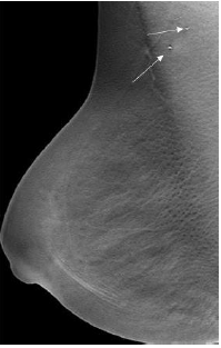 Click here to view Large image 11