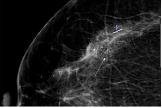 Click here to view Large image 14