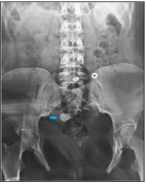 Click here to view Large image 1