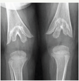 Click here to view Large Figure 1a