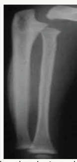 Click here to view Large Figure 12b