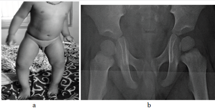 Click here to view Large Figure 2