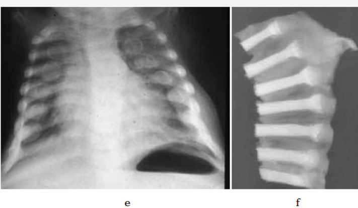 Click here to view Large Figure 2e