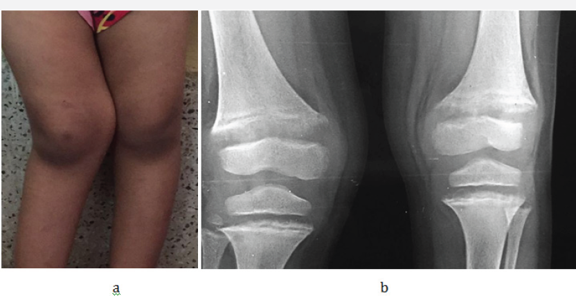 Click here to view Large Figure 3