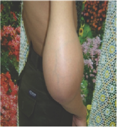 Click here to view Large Figure 1