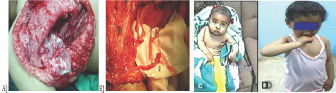 Click here to view Large Figure 1