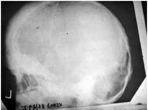 Click here to view Large image 2