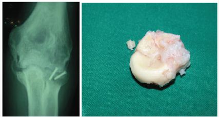 Click here to view Large Figure 5